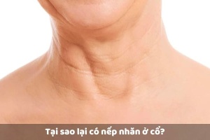 Mẹo Giảm Nếp Nhăn Vùng Cổ Đơn Giản